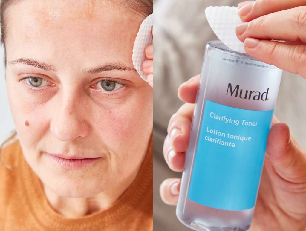 The 8 Best Toners for Combination Skin of 2025, According to Testers and Derms