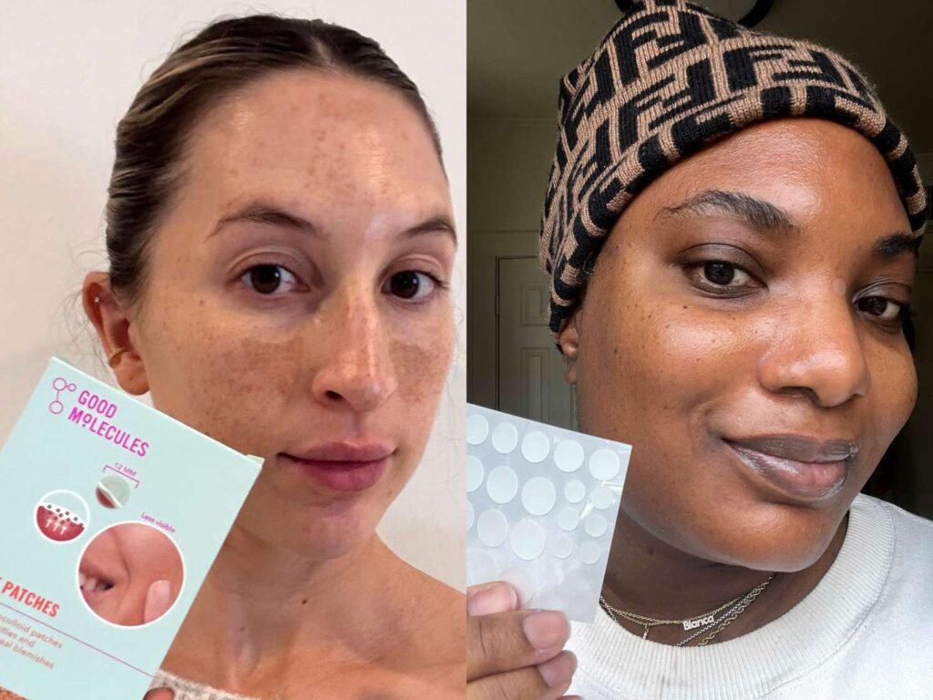 The 9 Best Acne Patches of 2025, Tested and Reviewed The 9 Best Acne Patches of 2025, Tested and Reviewed