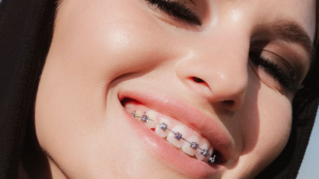 An Adult’s Guide to Getting Braces An Adult’s Guide to Getting Braces