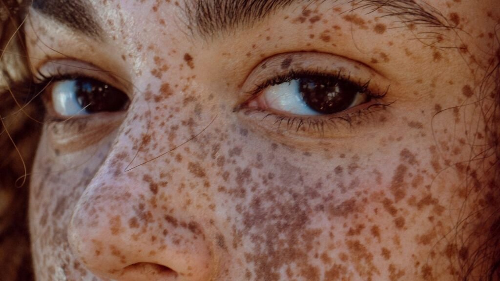 These Are the Best Radio Frequency Devices to Stimulate Collagen Production