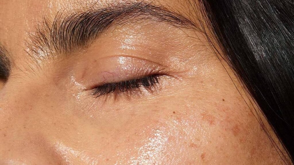 This Traditional Chinese Medicine Hack Clears an Acne Breakout Fast