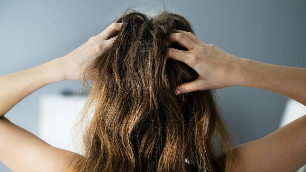 How to Get Rid of Dandruff, According to Dermatologists in 2026