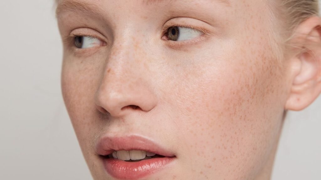 The Best Azelaic Acid Products Tackle Breakouts, Dark Spots, and Redness All at Once