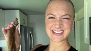 How Shaving My Head Helped Me Embrace My Psoriasis